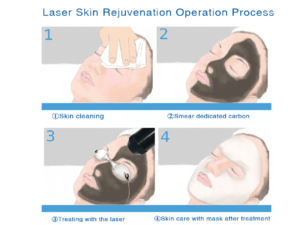 Karbon peeling, Bőrrejuvenáció