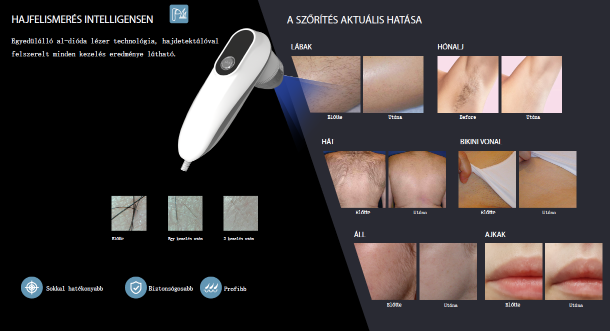 hairless-vario-mukodes-3