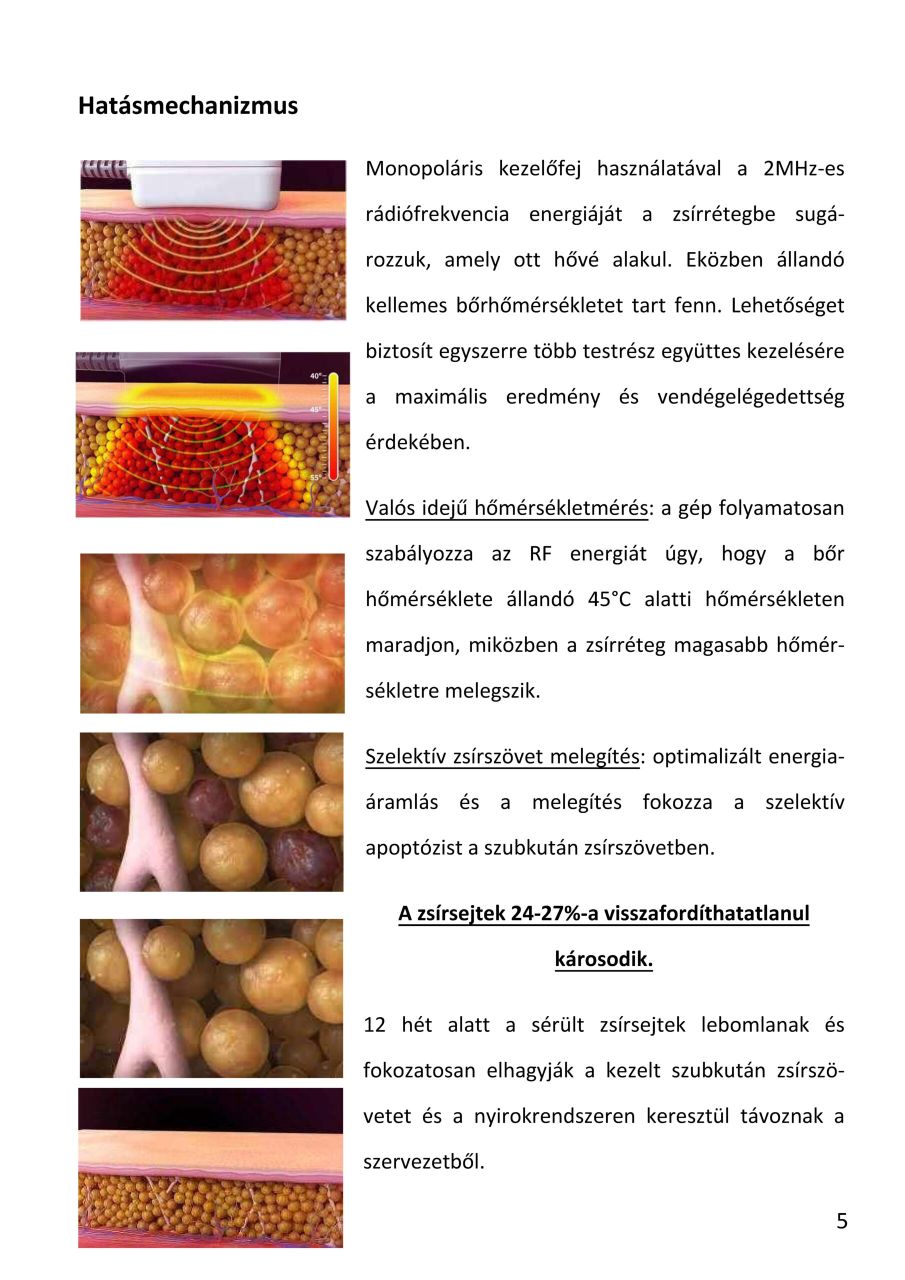 MonoShape Alakformáló gép MonoShape Alakformáló gép