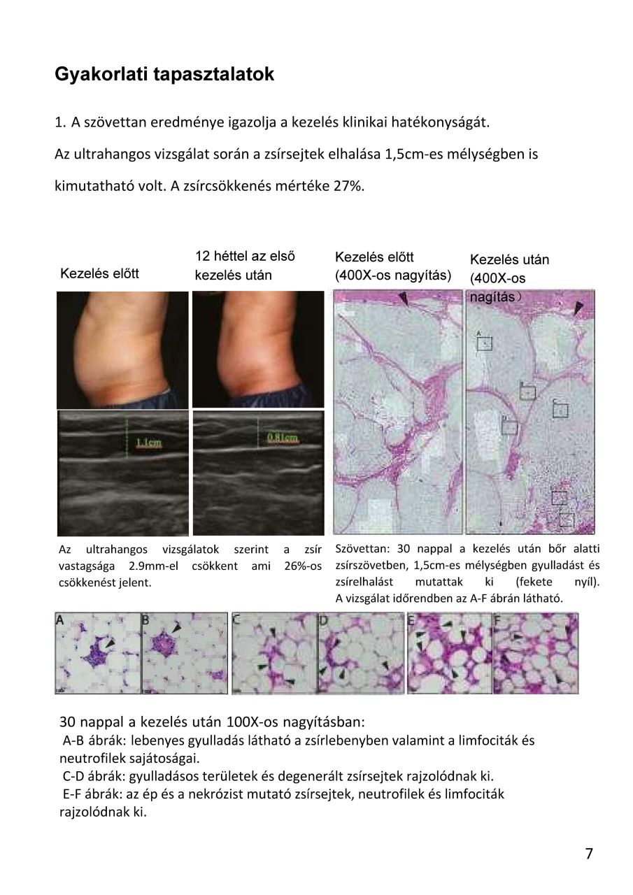 MonoShape Alakformáló gép MonoShape Alakformáló gép