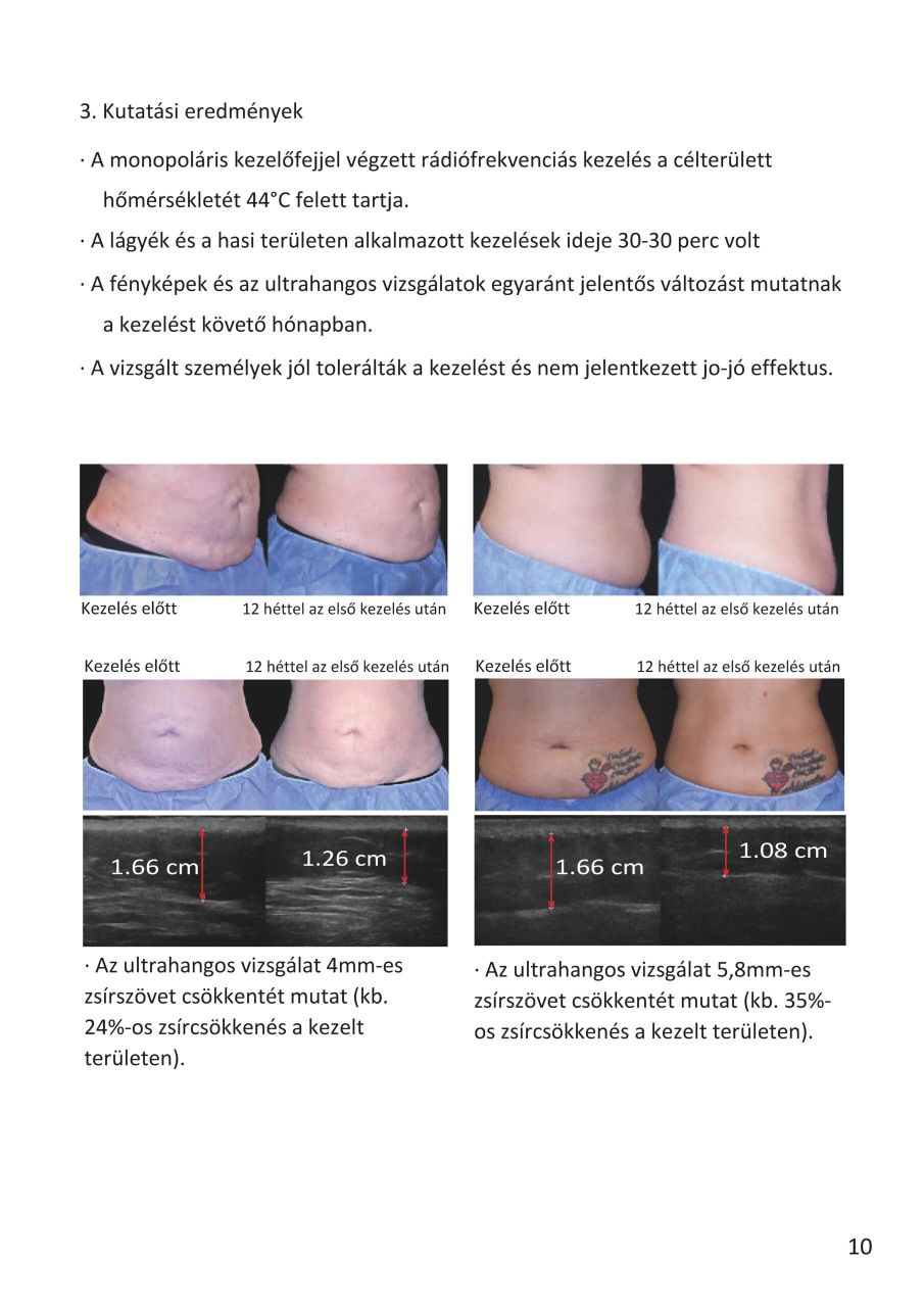 MonoShape Alakformáló gép MonoShape Alakformáló gép